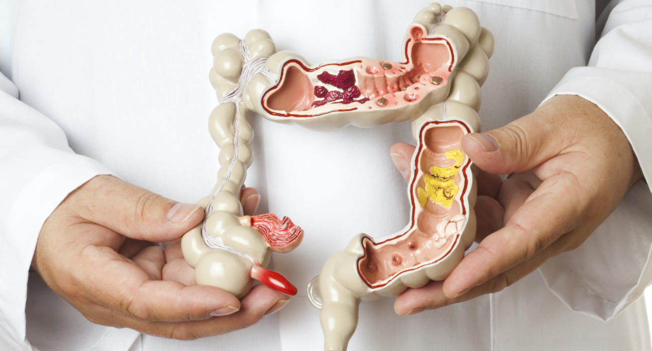 Advantages of Rectal Suppositories